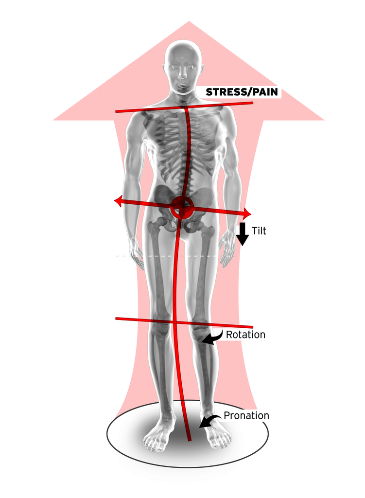 Proper Foot Support & What Custom Orthotics can do for You.